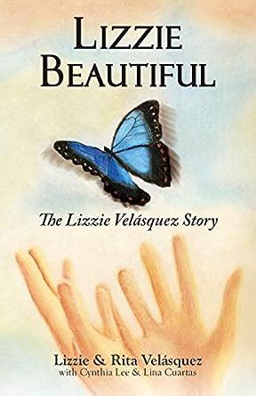 Lizzie Beautiful: The Lizzie Velasquez Story : Velasquez, Lizzie ...