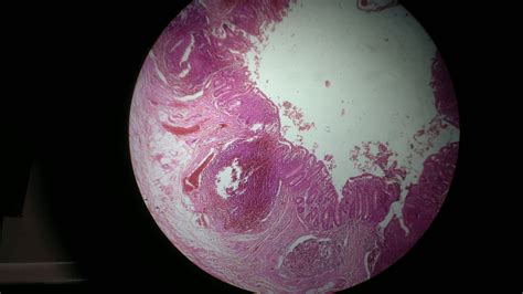 File:Histology of human appendix.jpg - Wikimedia Commons