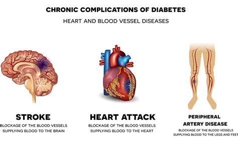 Healthy Blood Glucose Levels: prevention and treatment complications of ...