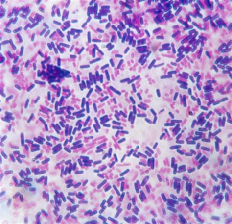 Gram Stain Procedure in Microbiology