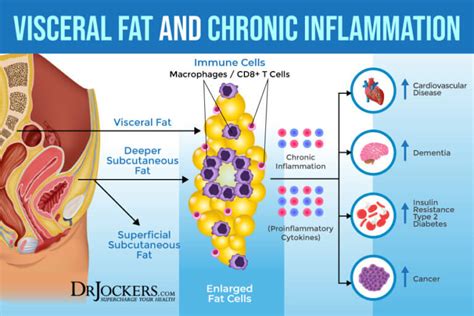 Visceral Fat: What is It and How it Drives Up Inflammation