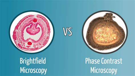 Brightfield vs Phase Contrast Microscopy: The Differences Explained ...