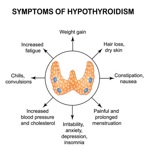 World Thyroid Day Is the Time to Raise Awareness About Thyroid Health ...