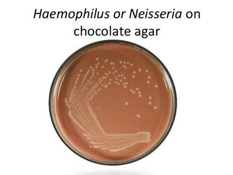 Chocolate Agar media - Preparation and Uses - Laboratoryinfo.com