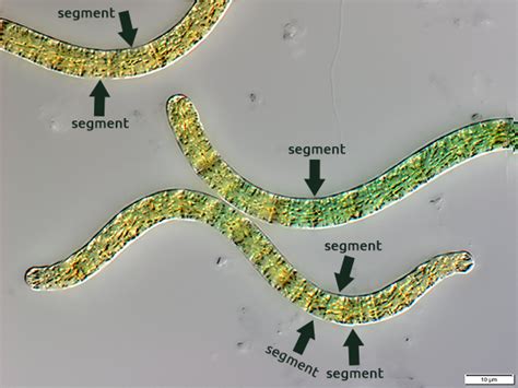 Spirulina under the microscope - Freshly Frozen Sprulina