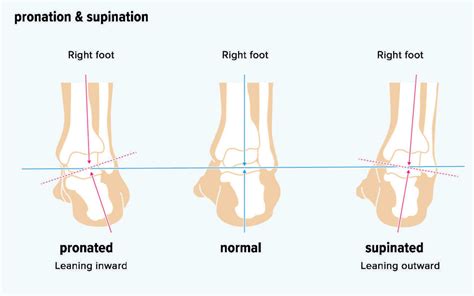 Pronation & Supination – Foot of the Rockies