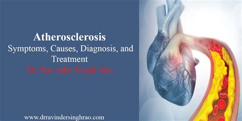 Atherosclerosis- Symptoms | Causes | Diagnosis | and Treatment