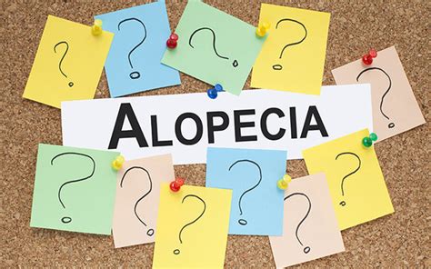 Alopecia Totalis: Symptoms, Causes, Treatments & Risk Factors – SkinKraft