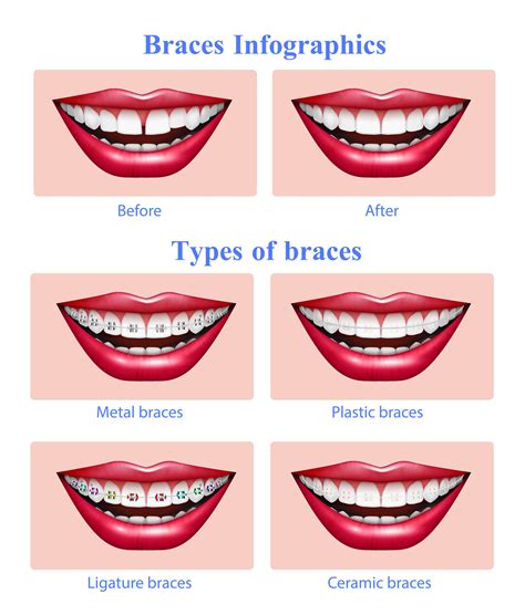 Boca Dental And Braces Rainbow - Your Trusted Dental Care Partner