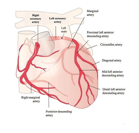 Coronary angiography - Centre de Cardiologie Interventionnelle Belledonne