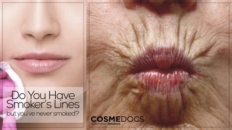 How To Reduce Smokers Lips | Lipstutorial.org