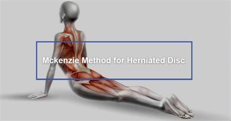 Mckenzie Method for Herniated Disc - Dr. Kevin Pauza, The Discseel ...