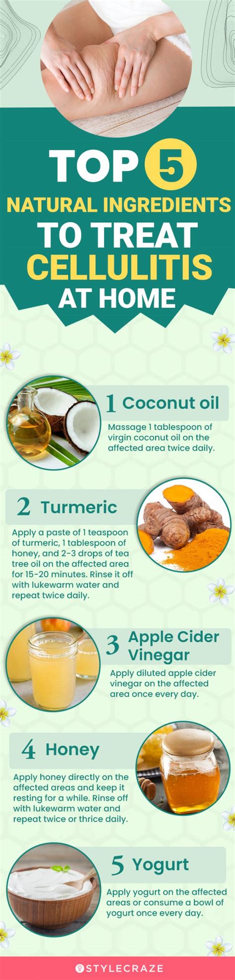 Cellulitis Treatment