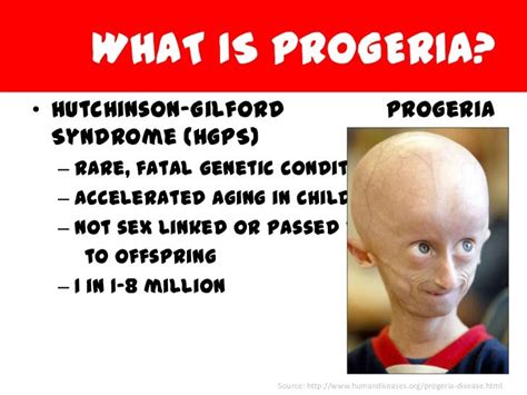 Biology project progeria