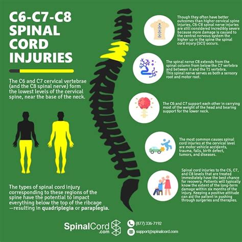 Cervical Spine | C6, C7, C8 Vertebrae | Spinal Cord Injury | Fracture