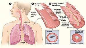 What Is Albuterol? - Uses & Side Effects | Study.com