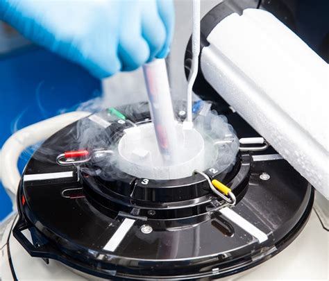 IVF with Frozen Embryo Transfer Process in Delhi- Embryo Freezing ...