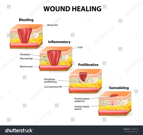 What Is The Maturation Phase Of Wound Healing - BEST HOME DESIGN IDEAS