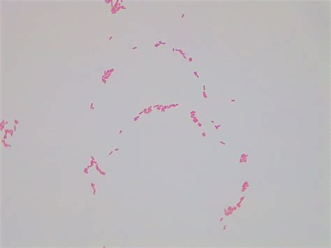 Micrograph Enterobacter aerogenes gram stain 1000X p000175 | OER Commons