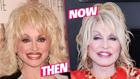 Dolly Parton's Plastic Face Fiasco Revealed In Shocking New Photos