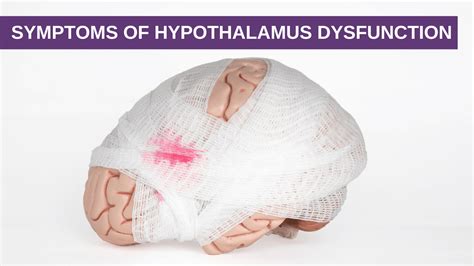 Symptoms of Hypothalamus Dysfunction - Genesis Gold