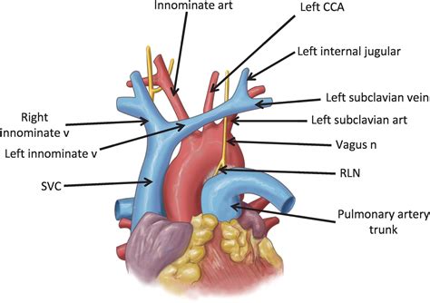 Subclavian Vein Heart