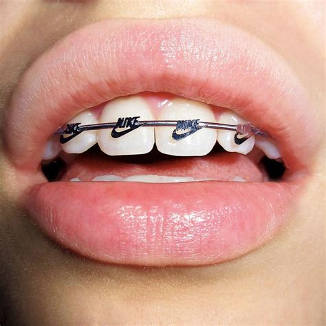 Source: itsnicethat.com | Braces colors, Cute braces, Cute braces colors