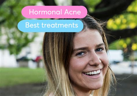 Hormonal acne: Best treatment according to Dermatologists | MDacne