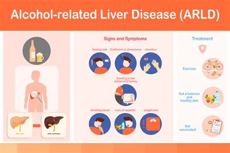 Vector illustration.infographic Signs and Symptoms of Alcoholic Fatty ...