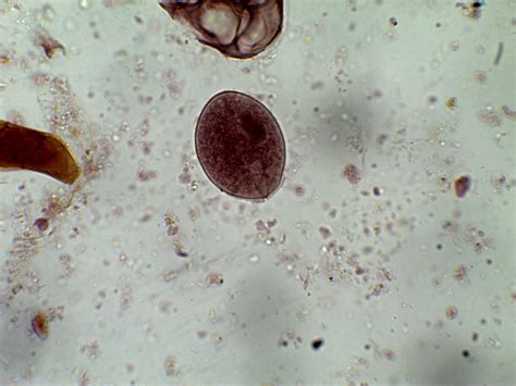 Balantidium coli – Trophozoite – Parasitology