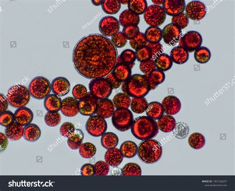 Haematococcus Pluvialis Cyst Algae Under Microscopic Stock Photo (Edit ...