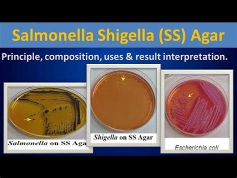 Salmonella shigella (SS) Agar. - YouTube