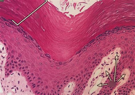 Thick keratinized stratified squamous epithelium Diagram | Quizlet