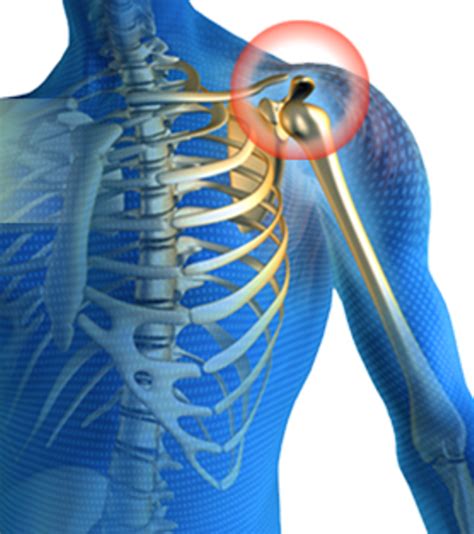 Shoulder Joint Pain - Causes, Treatment And Exercises For Natural Pain ...