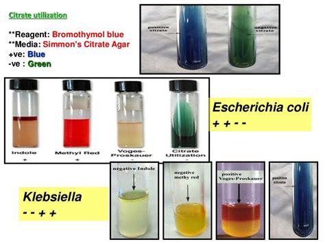 Biochemical tests