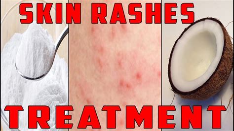 Dry Skin Rash Treatment