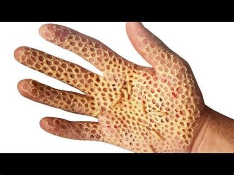 Pin de Brent Levandoski en Trypophobia skin | Tripofobia