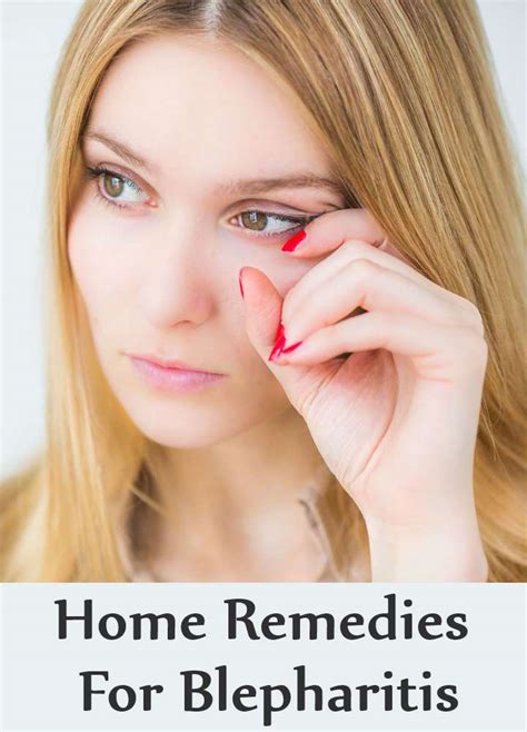 9 Home Remedies For Blepharitis | Search Home Remedy