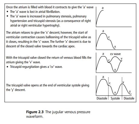 Signs of Jugular venous pressure