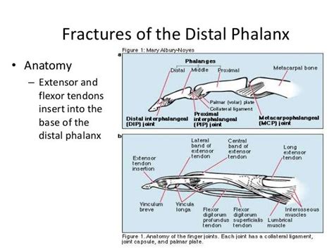 Distal phalanx fracture