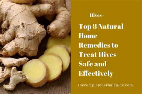 8 Ways to Get Rid of Hives - Health and Natural Healing Tips