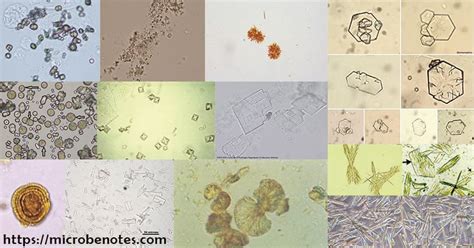 Urine Microscopy Labeled