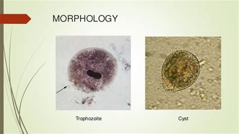 Balantidium coli