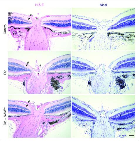 NAM prevents optic nerve cupping in glaucoma. The presence of optic ...