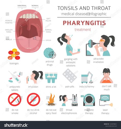 Tonsils Throat Diseases Pharyngitis Symptoms Treatment Stock Vector ...