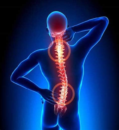 Spinal Arthritis & Disc Degeneration Treatment