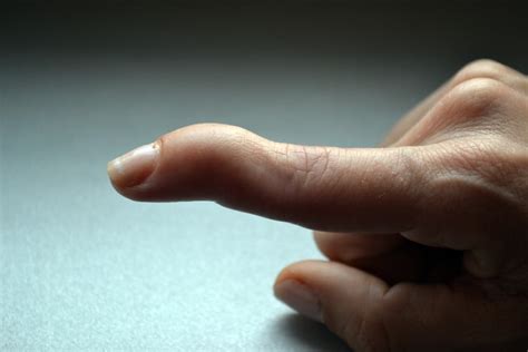 Amazing 6 Mallet Finger Exercises For Quick Recovery