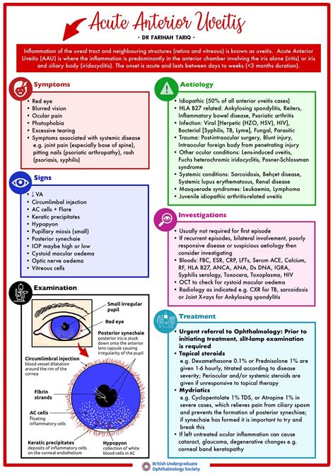 Acute Anterior Uveitis – British Undergraduate Ophthalmology Society