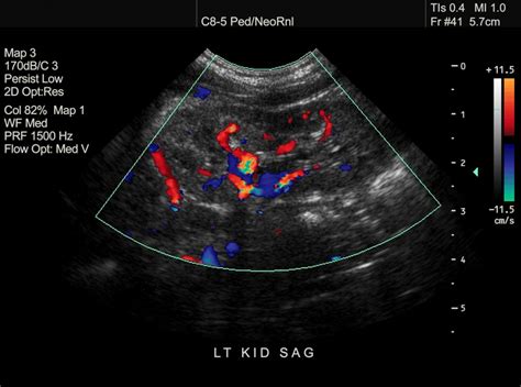 Ultrasound scans: How do they work?