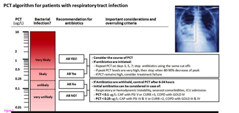 The Life of a PA Student : Procalcitonin: What is its value clinically?